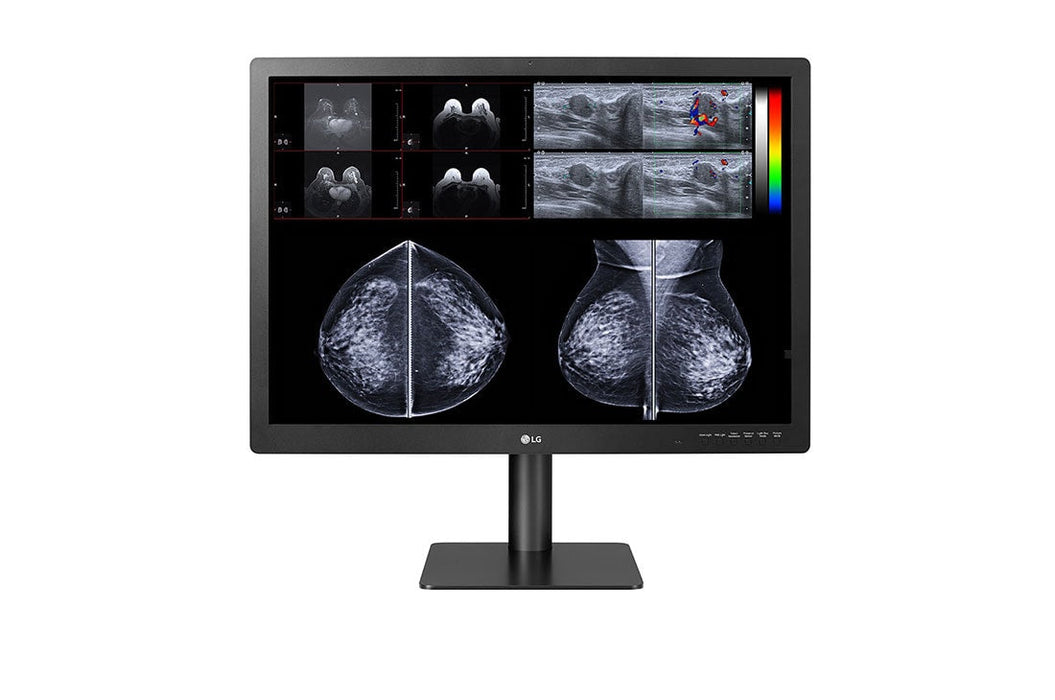 LG 31” 12MP (4200x2800) IPS Diagnostic Monitor for Mammography with Multi-resolution Modes, Pathology Mode, Self-calibration, Focus View, PBP and Dual Controller LG