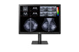 LG 31” 12MP (4200x2800) IPS Diagnostic Monitor for Mammography with Multi-resolution Modes, Pathology Mode, Self-calibration, Focus View, PBP and Dual Controller LG