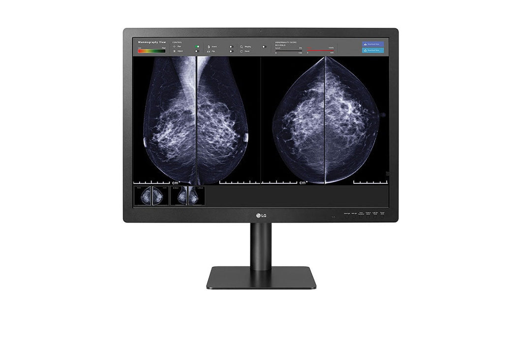 LG 31” 12MP (4200x2800) IPS Diagnostic Monitor for Mammography with Multi-resolution Modes, Pathology Mode, Self-calibration, Focus View, PBP and Dual Controller LG